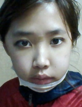 两颚、颧骨、兜下巴、双眼皮