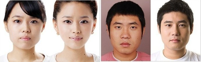 北京华意隆鼻医生李沁奕手术案例