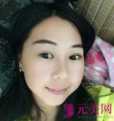 王侠磨骨