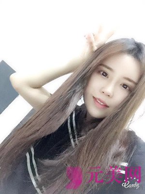 做完鼻部手术+眼部手术手术果前后照对比变化