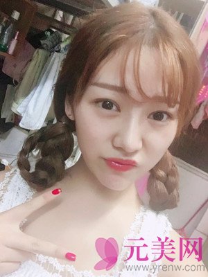 北京垫下巴+硅胶假体隆鼻手术前后对比恢复过程日记