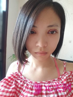 小眼睛做完眼部手术双眼皮+开眼角前后恢复过程