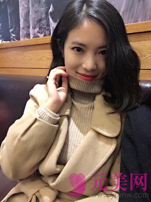 小眼睛做完眼部手术双眼皮+开眼角前后恢复过程