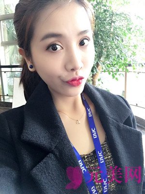自体脂肪填充太阳穴和脸颊前后对比图过程日记