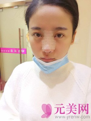 合肥韩美闫品行隆鼻怎么样?真人案例及价格