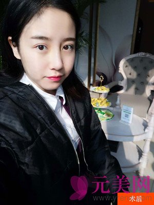 合肥韩美闫品行隆鼻怎么样?真人案例及价格