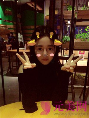 合肥韩美闫品行隆鼻怎么样?真人案例及价格