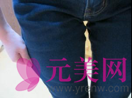 武汉爱思徐庶吸脂怎么样?价格?前后真人案例