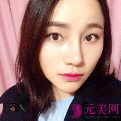 上海伊莱美王世专隆鼻怎么样?价格?前后真人案例