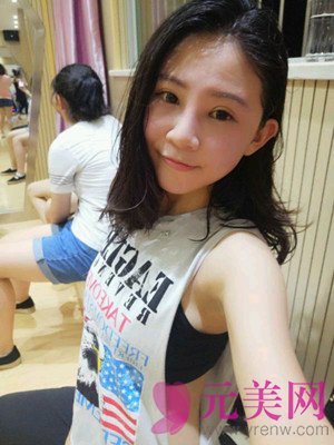 保定蓝山杜建龙隆鼻怎么样?眼部手术鼻部手术对比案例