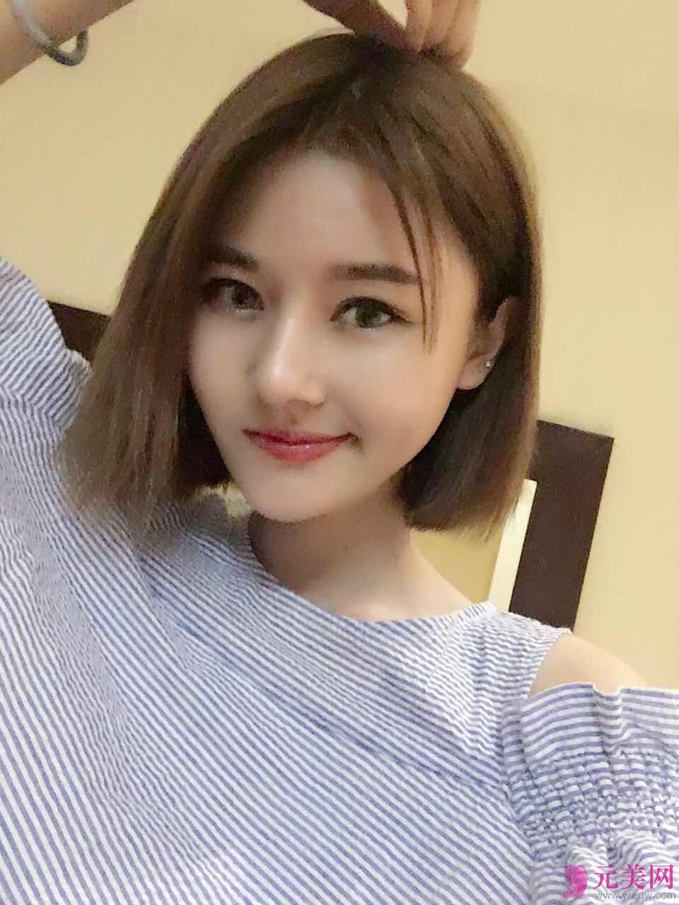 北京炫美张海龙鼻部手术真人案例恢复图