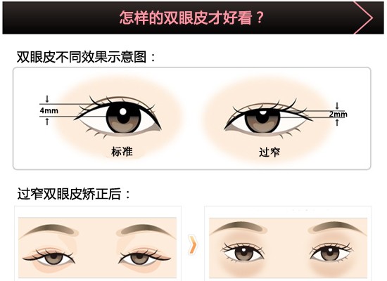 怎么样的双眼皮才好看.jpg