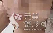 北京八大处滕利下颌角案例